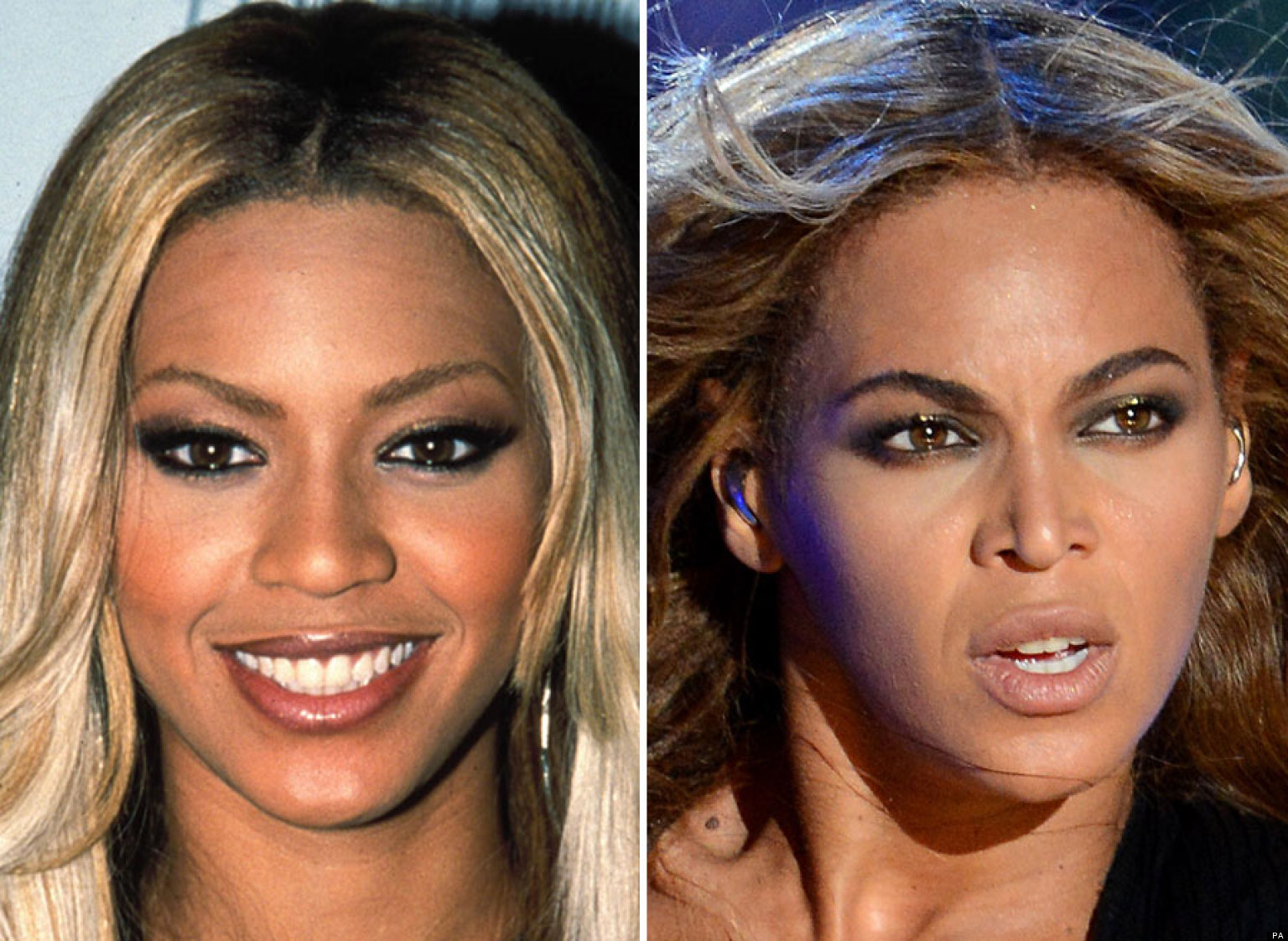 Beyonce Nose Job