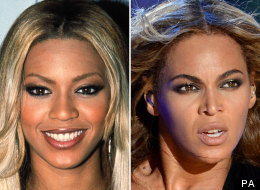 Has Beyoncé Had A Nose Job?