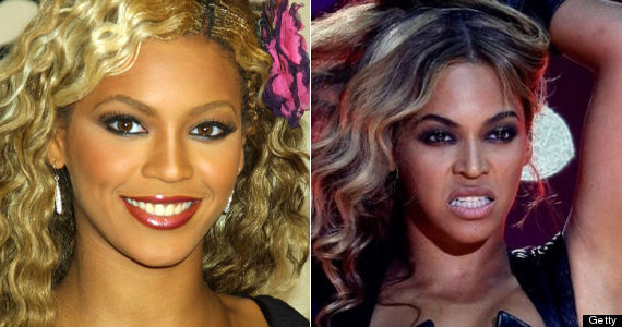 beyonce nose job