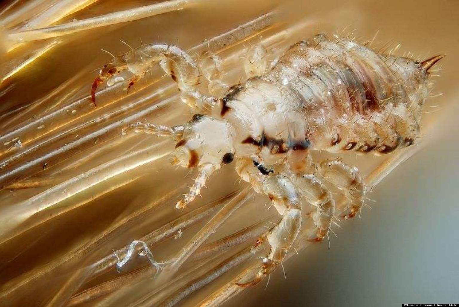 Human Parasites Nematodes Flatworms Protozoa Explained VIDEO 