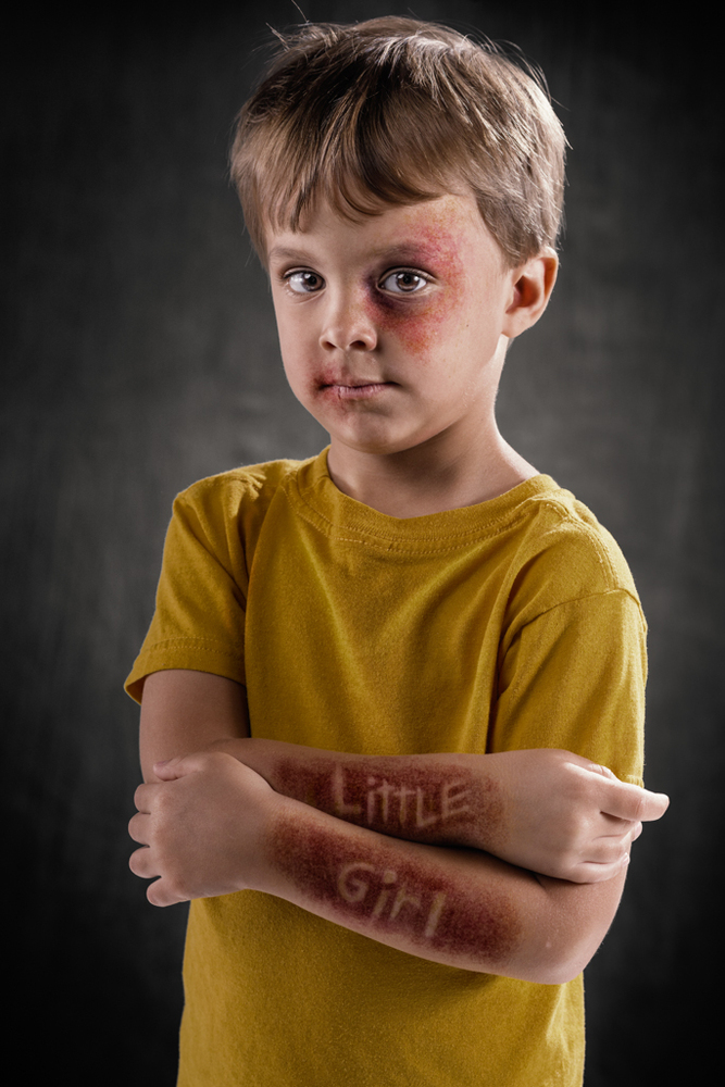 Powerful Images Show A World Where Verbal Abuse Leaves Physical Scars ...