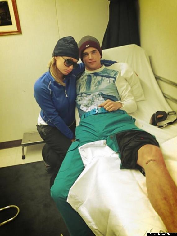 paris hilton poses boyfriend bleeds