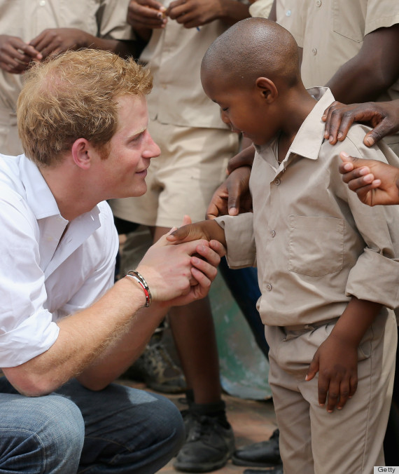 prince harry balding