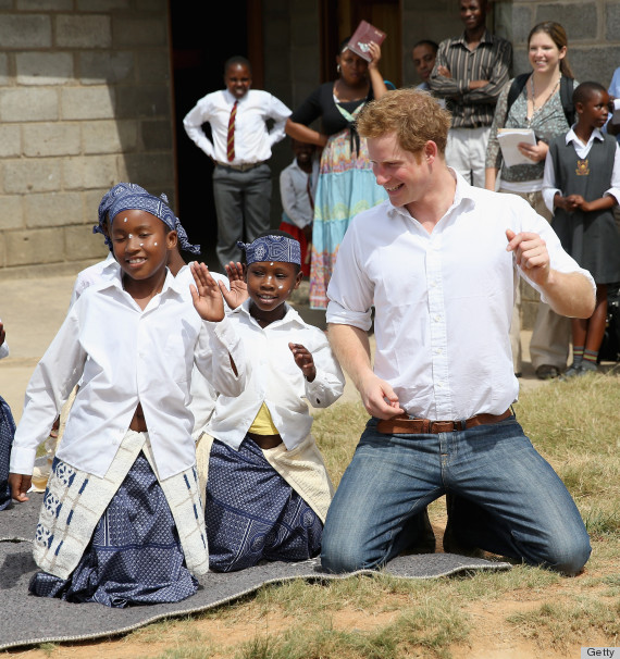 prince harry balding