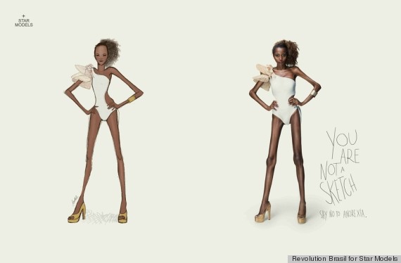 anorexia ads