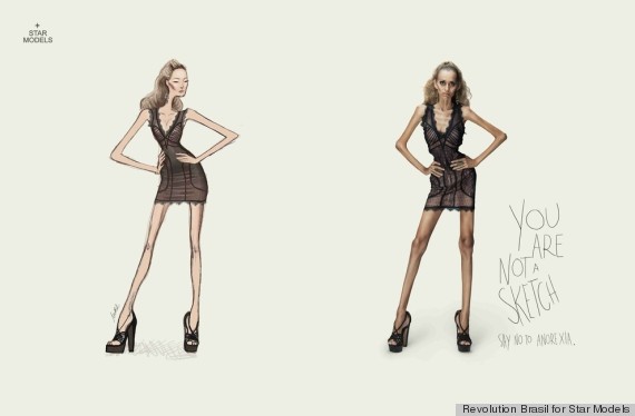 anorexia ads