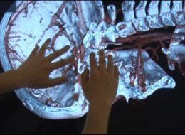 Virtual Autopsy Table: Death Goes Digital With Multitouch Table (VIDEO)