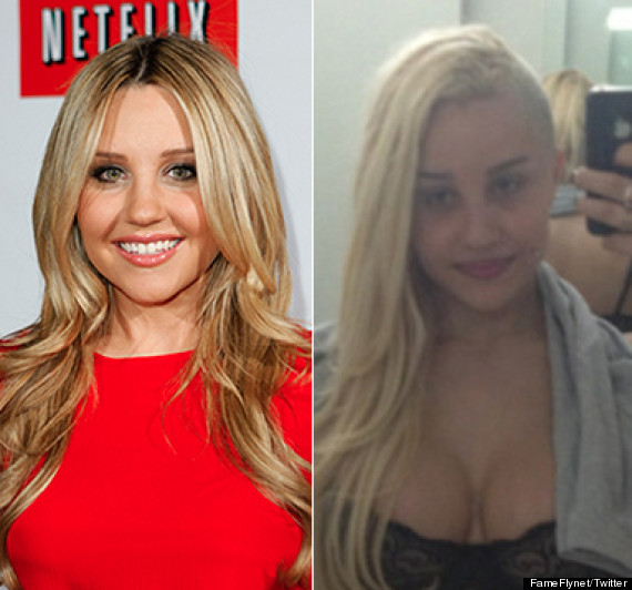 amanda bynes nose job