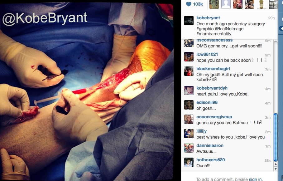 kobe bryant achilles photo