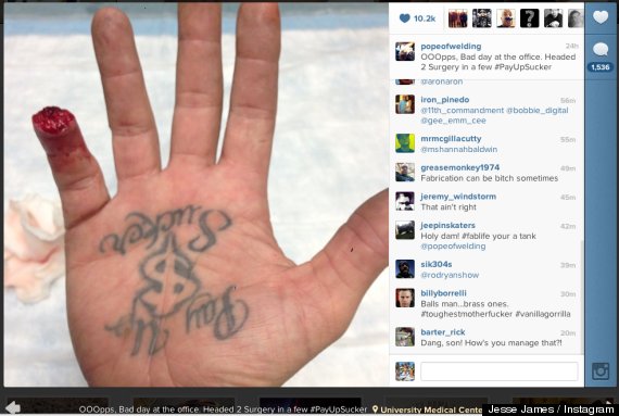 Jesse James Loses Finger In Machine Accident, Boasts On Instagram ...