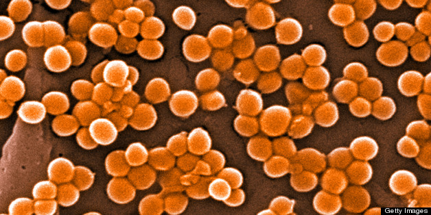 Pfizer Takes Its Shot At A Vaccine For Evasive MRSA Superbug | HuffPost