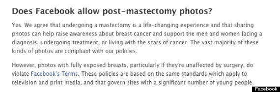 postmastectomy