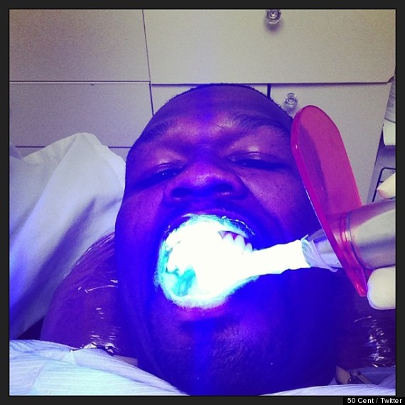 50 cent dentist