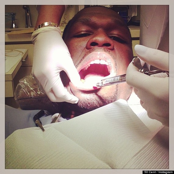 50 cent dentist