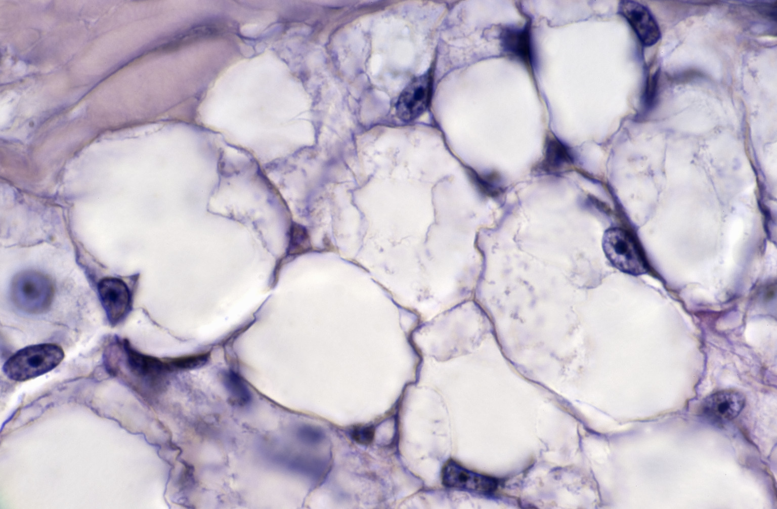Стволовые клетки жировой ткани под микроскопом