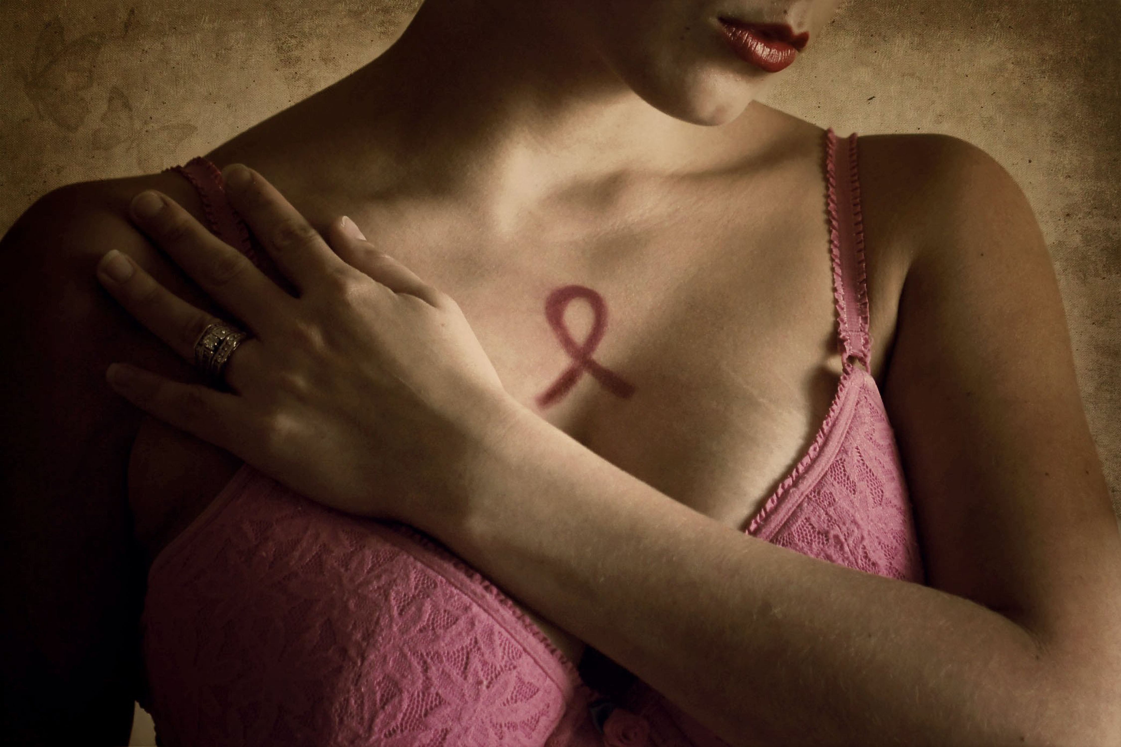 breast cancer