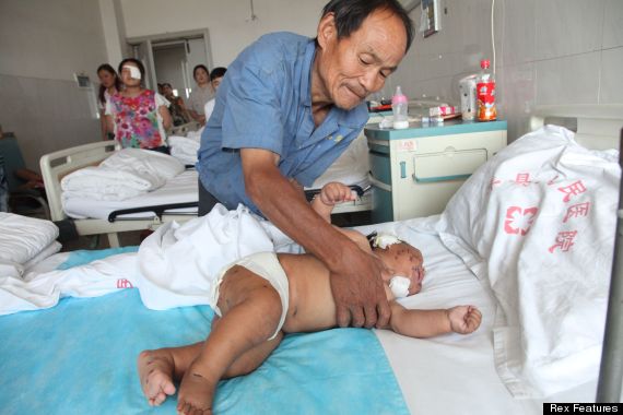 xiao bao baby stabbed with scissors