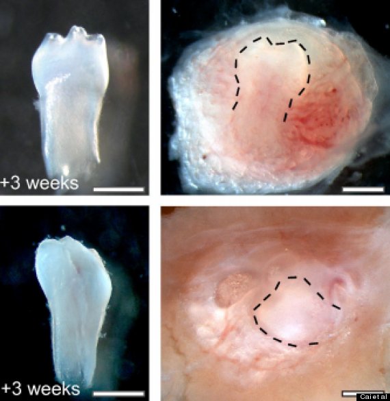 urine stem cells teeth