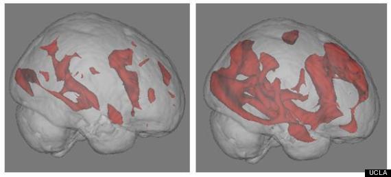 brain activity internet