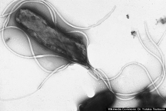 h pylori