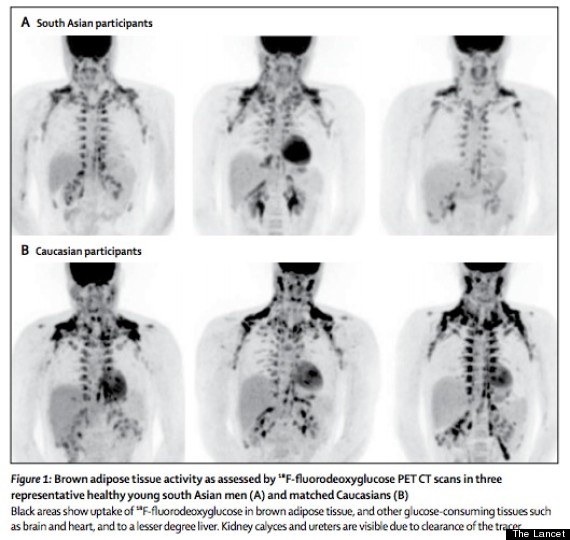 south asian brown fat
