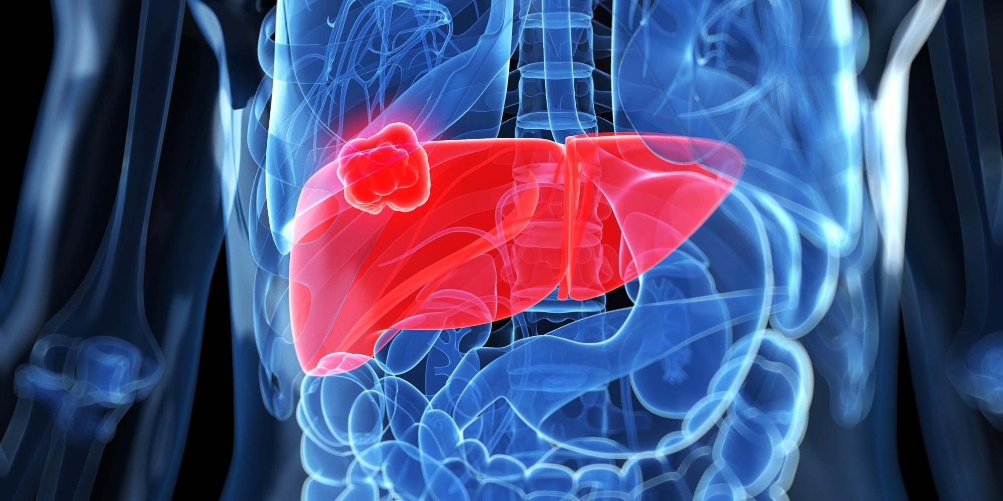 Diabetes Associated With Liver Cancer Risk | HuffPost