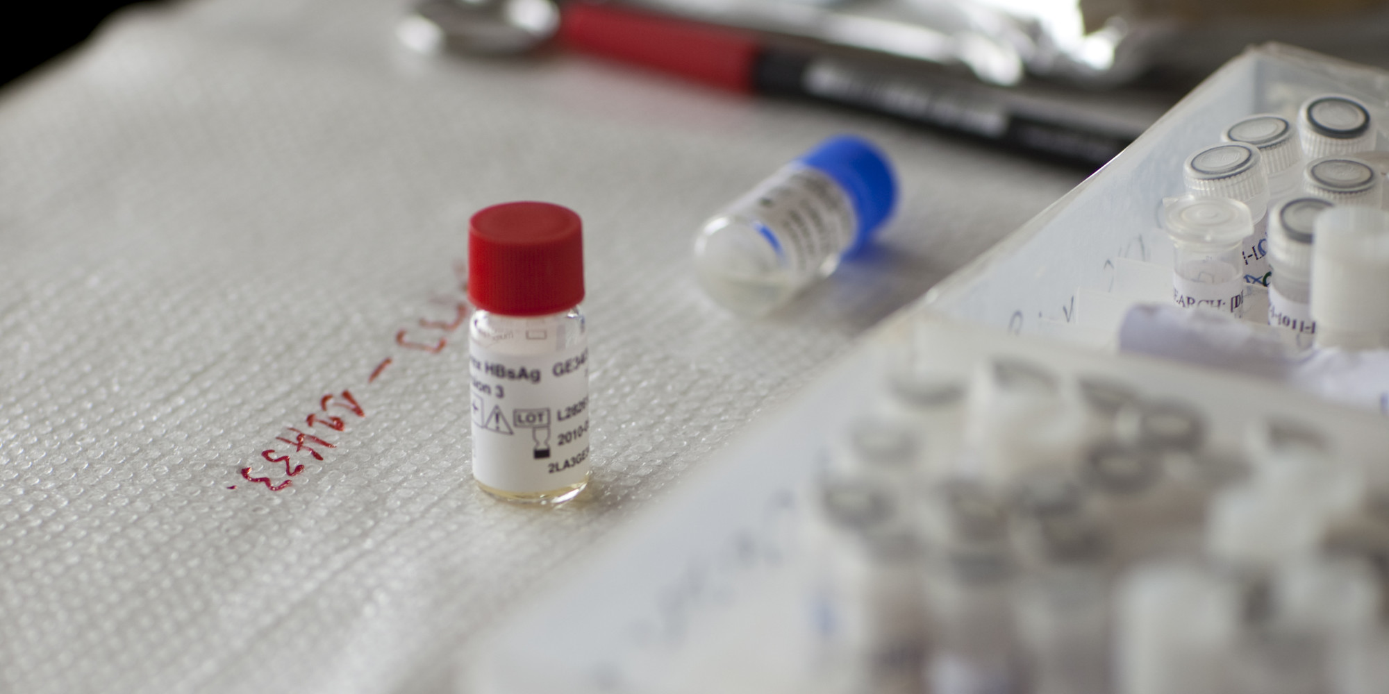 HIV Returns In Men Who Showed Signs Of 'Cure' | HuffPost