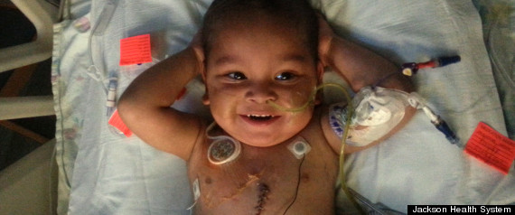 toddler 5 organ transplant