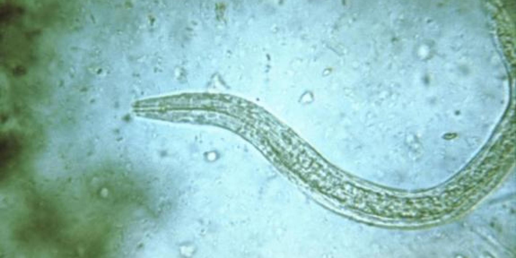 Hookworm Genome Sequenced, Raising Hopes Of Cures For Painful Infection