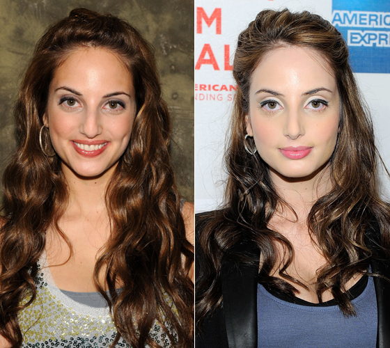 Alexa Ray Joel Nose Job Plastic Surgery Before After Photos Huffpost Entertainment