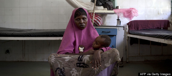 somalia malnutrition