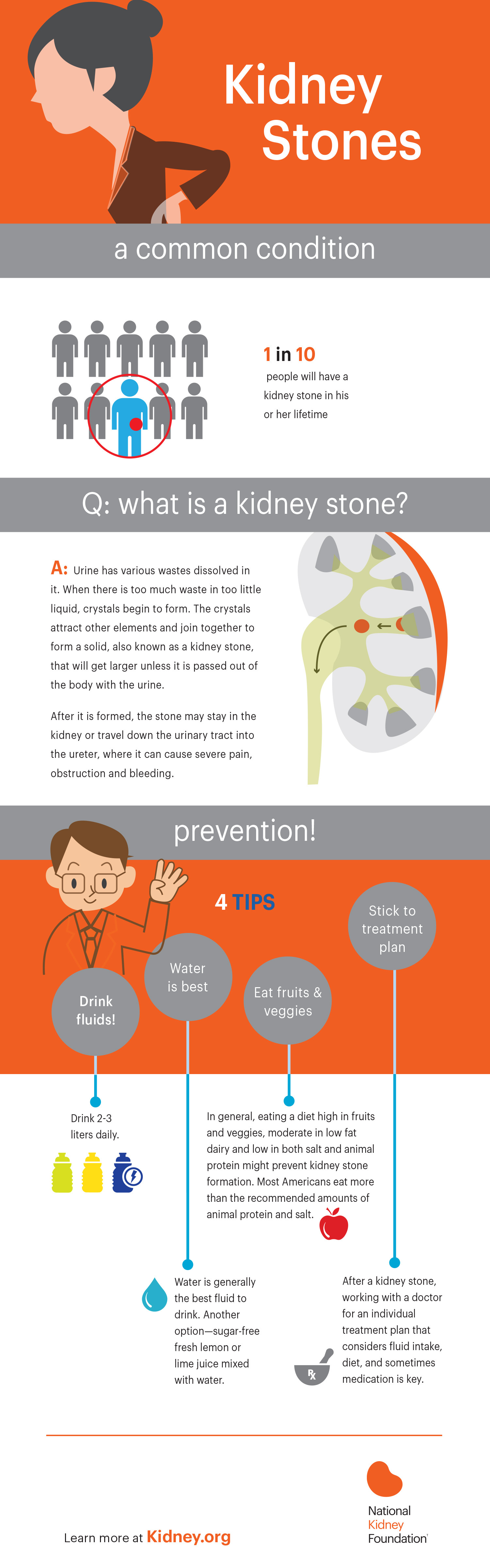 kidney stones infographic