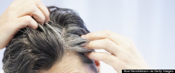 gray hair scalp