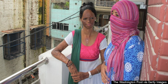 laxmi acid attack