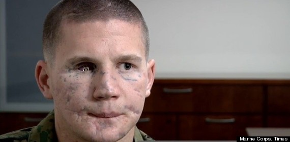 kyle carpenter