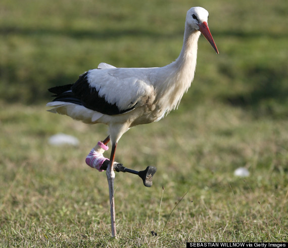 stork prosthetic