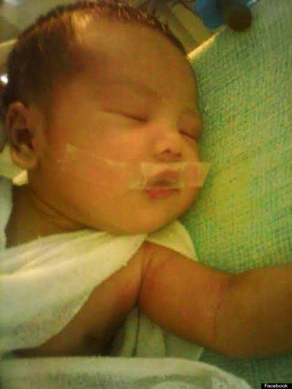 baby with mouth taped shut