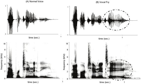 vocal fry