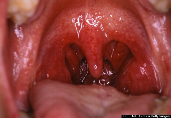 uvula