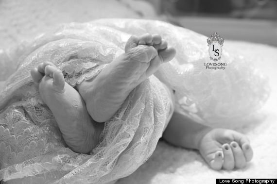 stillbirth photo