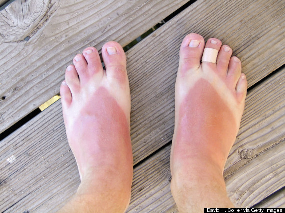 sunburn flip flops