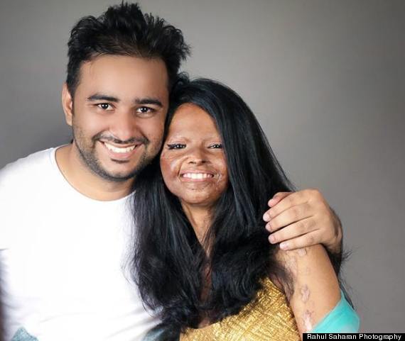 Acid Attack Survivors Pose For Photo Shoot Show Us What Beautiful Really Means Huffpost Impact 