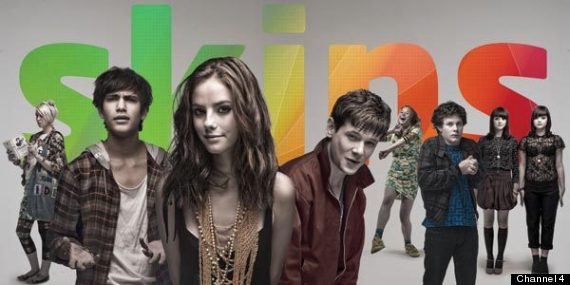 skins