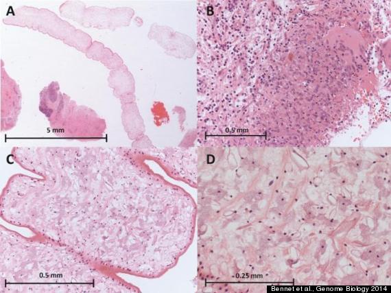 worm brain tissue