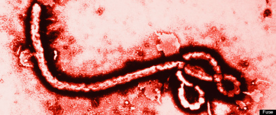 ebola virus