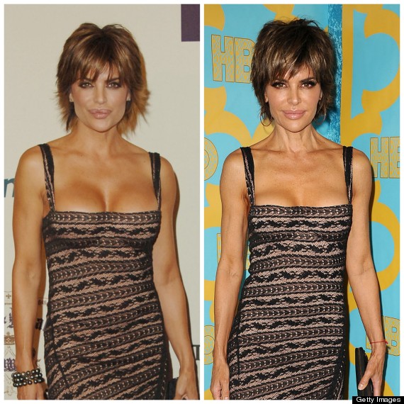 lisa rinna.