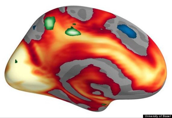 male female brain