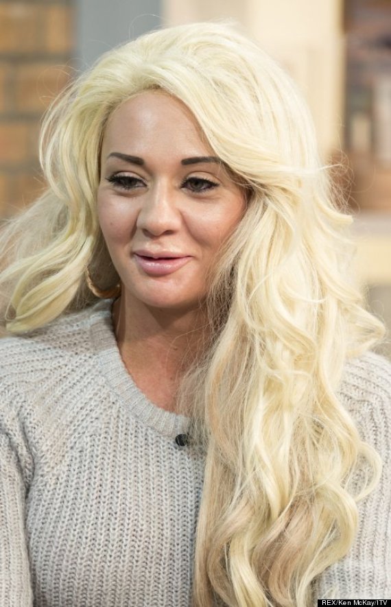 Model Josie Cunningham's £4,800 breast opand you foot the bill