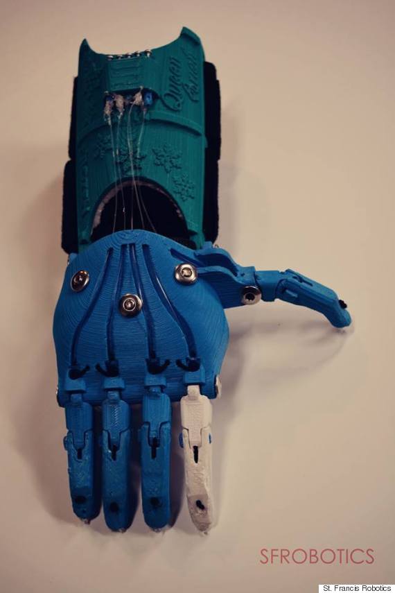 deer creek prosthetic hand