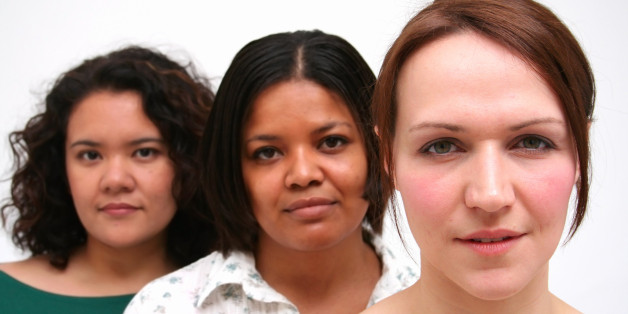 Skin color and health: it's not about race?